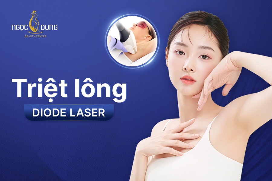 Công nghệ triệt lông Diode Laser