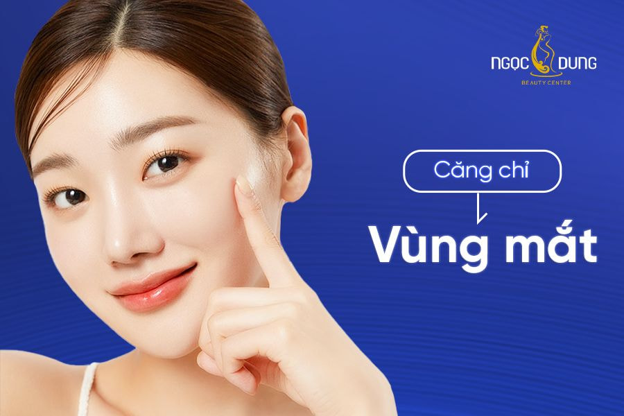 căng chỉ vùng mắt