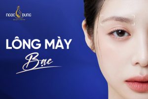 Lông mày bạc