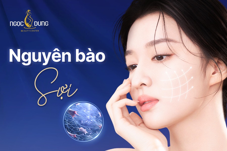 Nguyên bào sợi