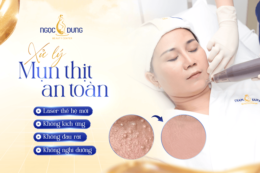 Điều trị mụn thịt công nghệ cao an toàn cho vùng mắt