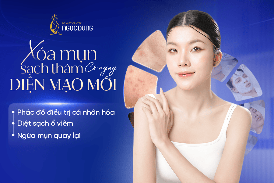 Trị mụn không tái phát với liệu trình công nghệ cao