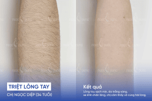 ba triet long tay 2