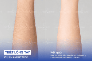 ba triet long tay 3