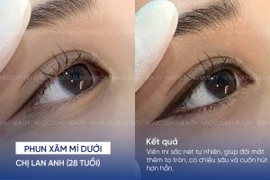 phun mí dưới 1
