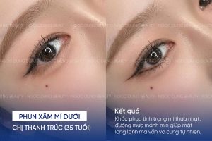 phun mí dưới 2