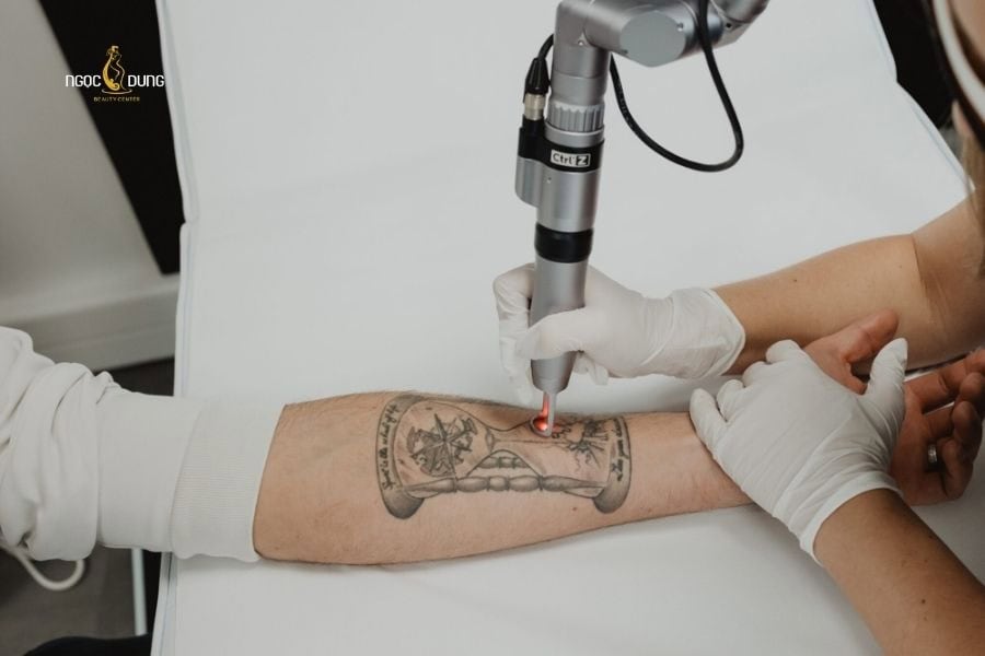 Ưu tiên các thẩm mỹ viện xóa xăm bằng công nghệ cao và hiện đại